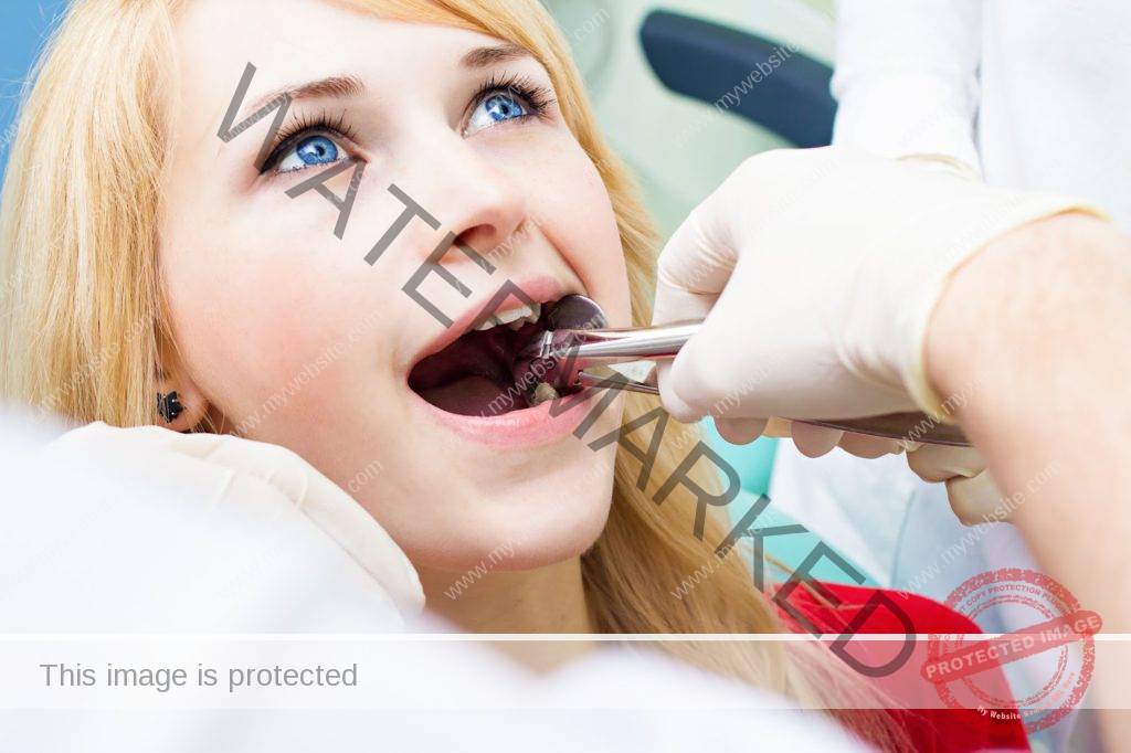 dental-extraction
